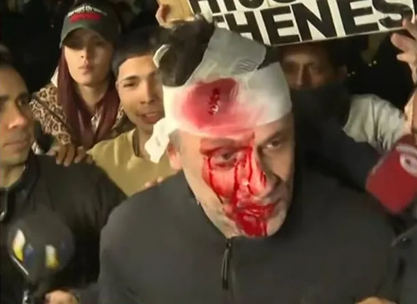 Incidentes en el acto de Javier Milei en Moreno: un periodista herido por un botellazo